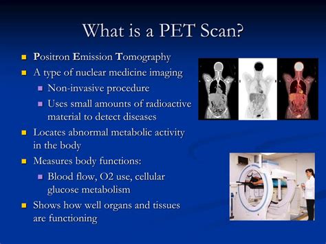PET Scan: Definition, Purpose, Procedure, and .